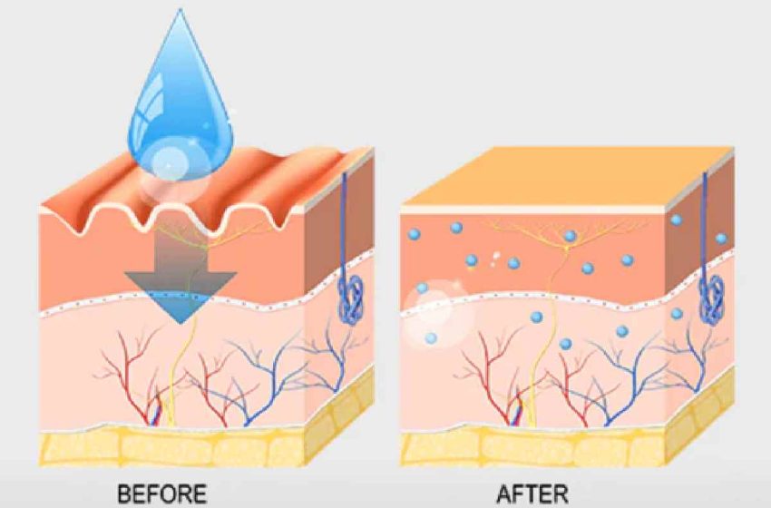 Hyaluronic Acid for Aging